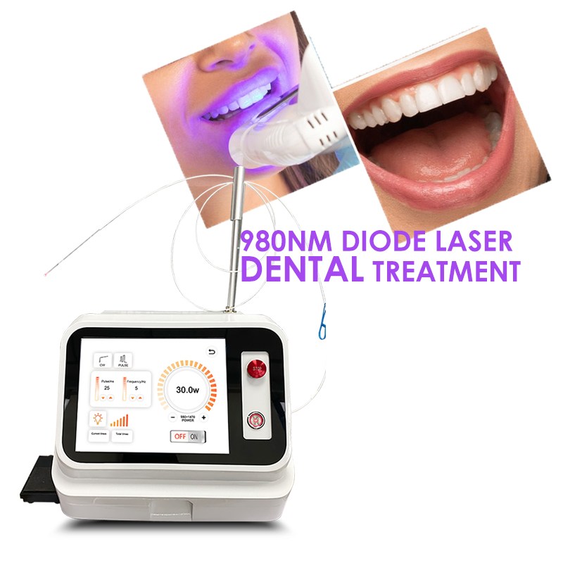Teeth Whitening With Laser - 2024 Gorąca Wyprzedaż: Laser do Leczenia