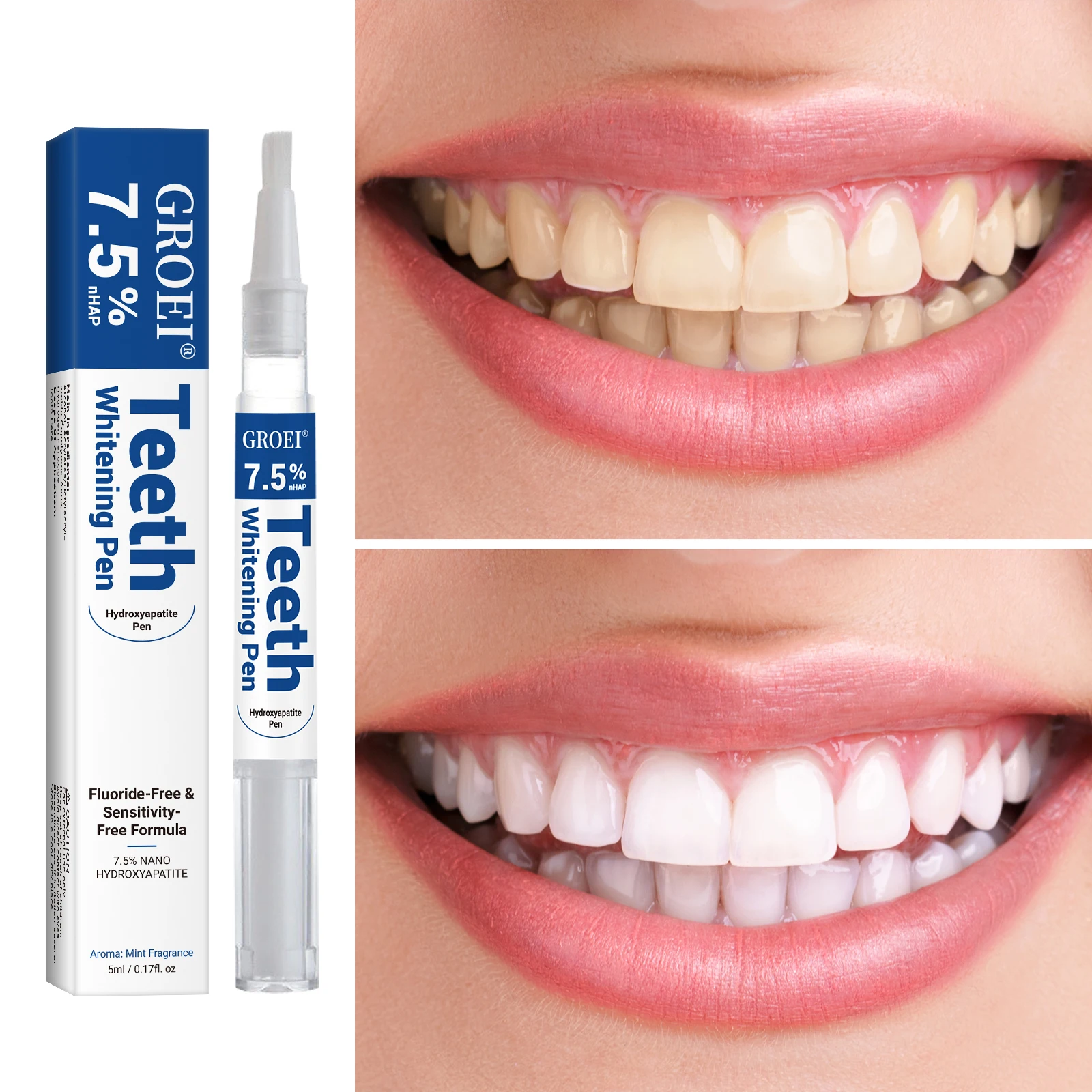 Hydroksiapatytowy długopis do  – Teeth Whitening Gels Used By Dentists recenzja i cena