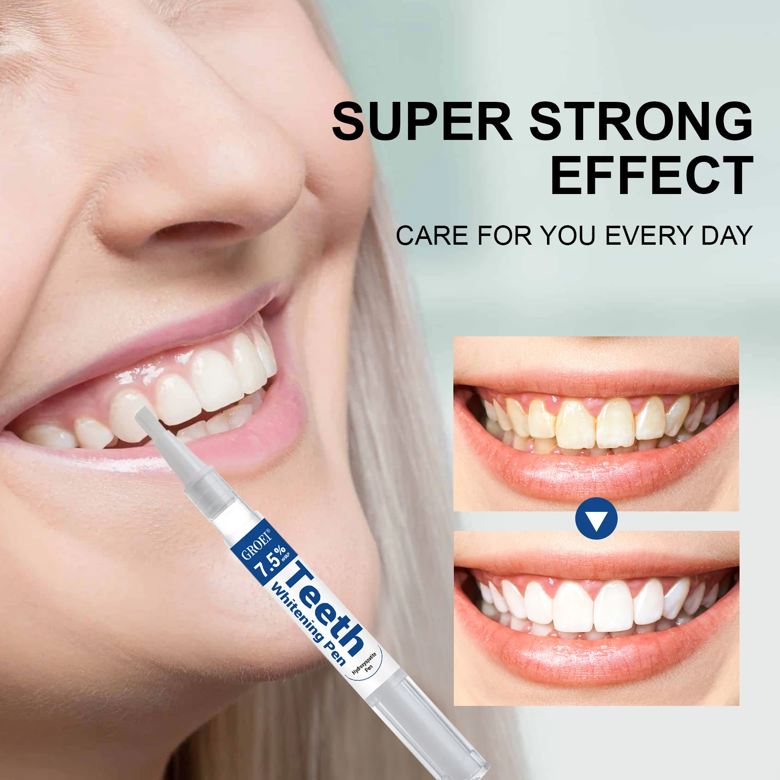 Hydroksiapatytowy długopis do  – Teeth Whitening Gels Used By Dentists recenzja i cena