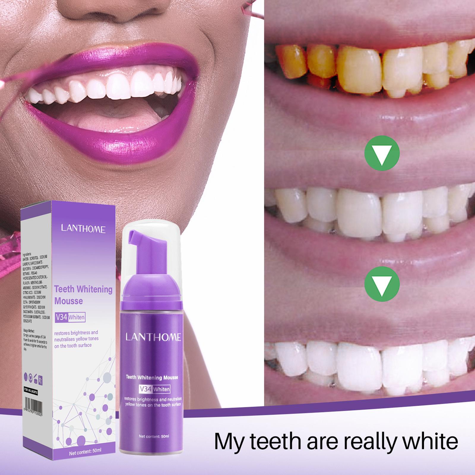 V34 Mus do czyszczenia zębów P – Teeth Whitening Crest recenzja i cena