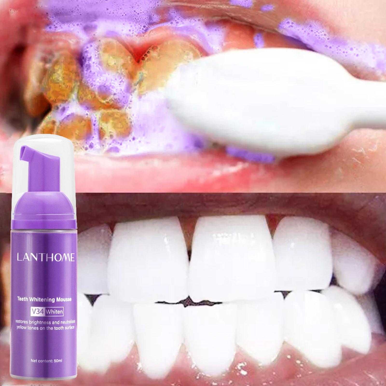 V34 Mus do czyszczenia zębów P – Teeth Whitening Crest recenzja i cena