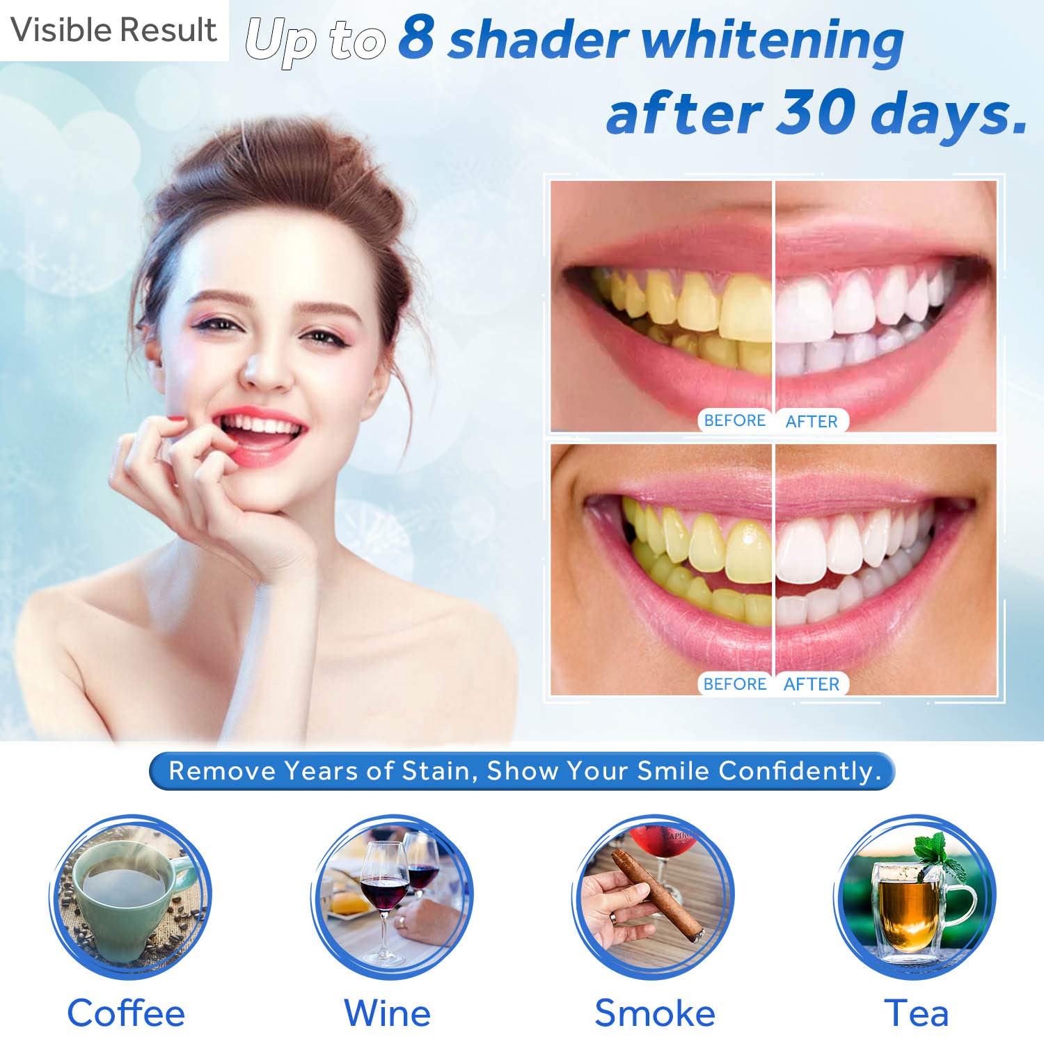 Żel do wybielania zębów w strz – Teeth Whitening Levels recenzja i cena