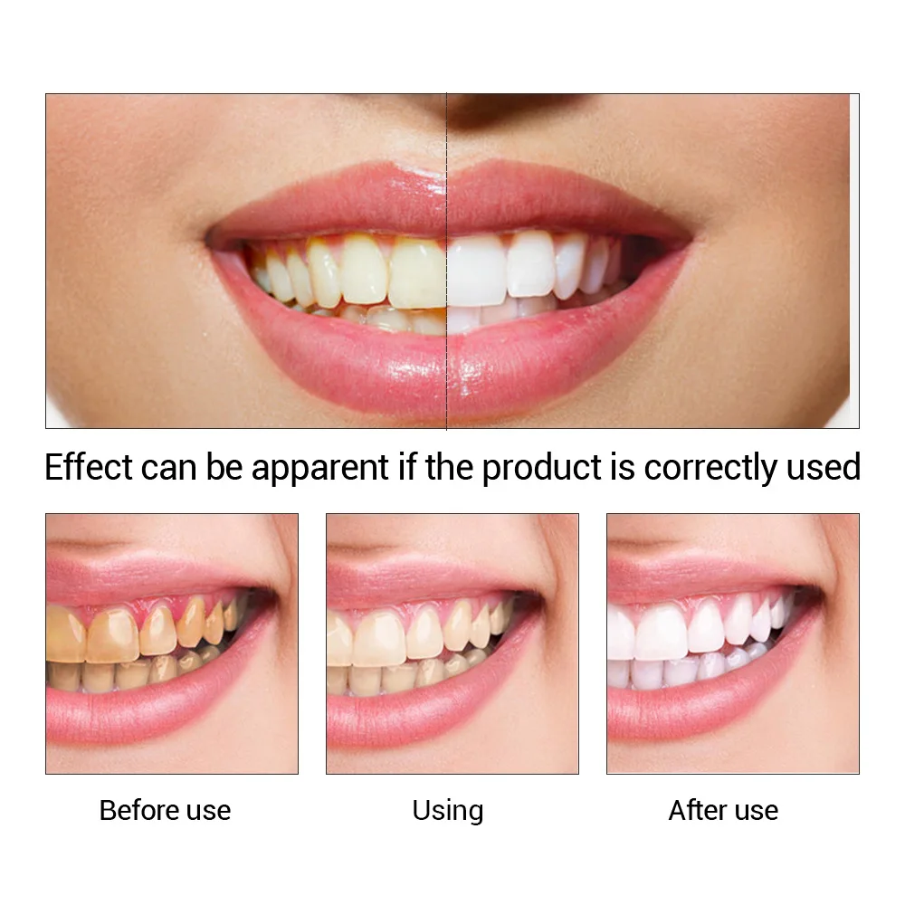 FTEENPLY esencja do wybielania – Teeth Whitening Levels recenzja i cena