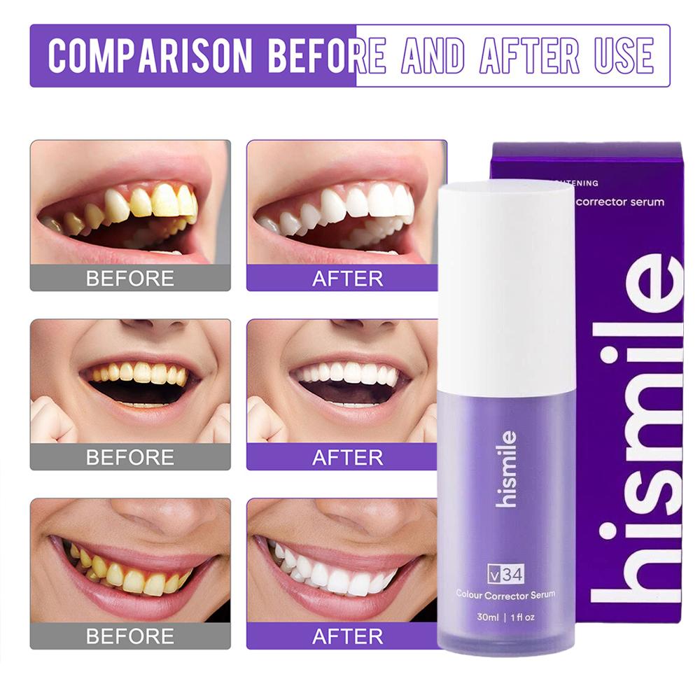    Fioletowe serum do wybiela – Teeth Whitening Crest recenzja i cena