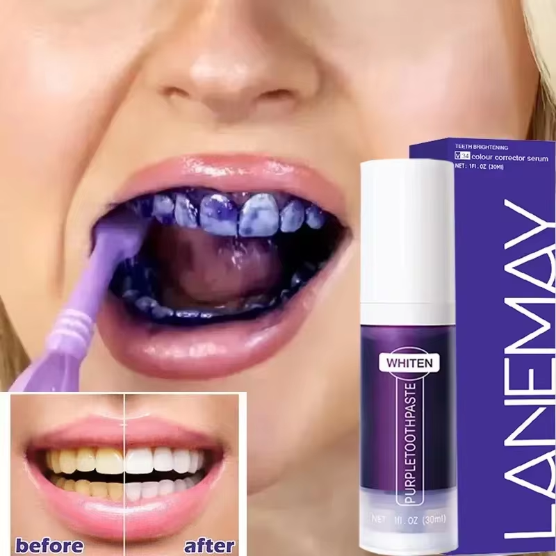 V34 fioletowa pasta do wybiela – Teeth Whitening Crest recenzja i cena