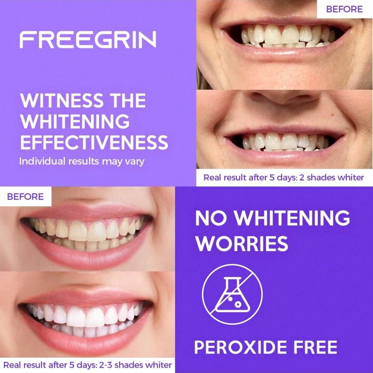 Naklejki wybielające do zębów  – Teeth Whitening Levels recenzja i cena